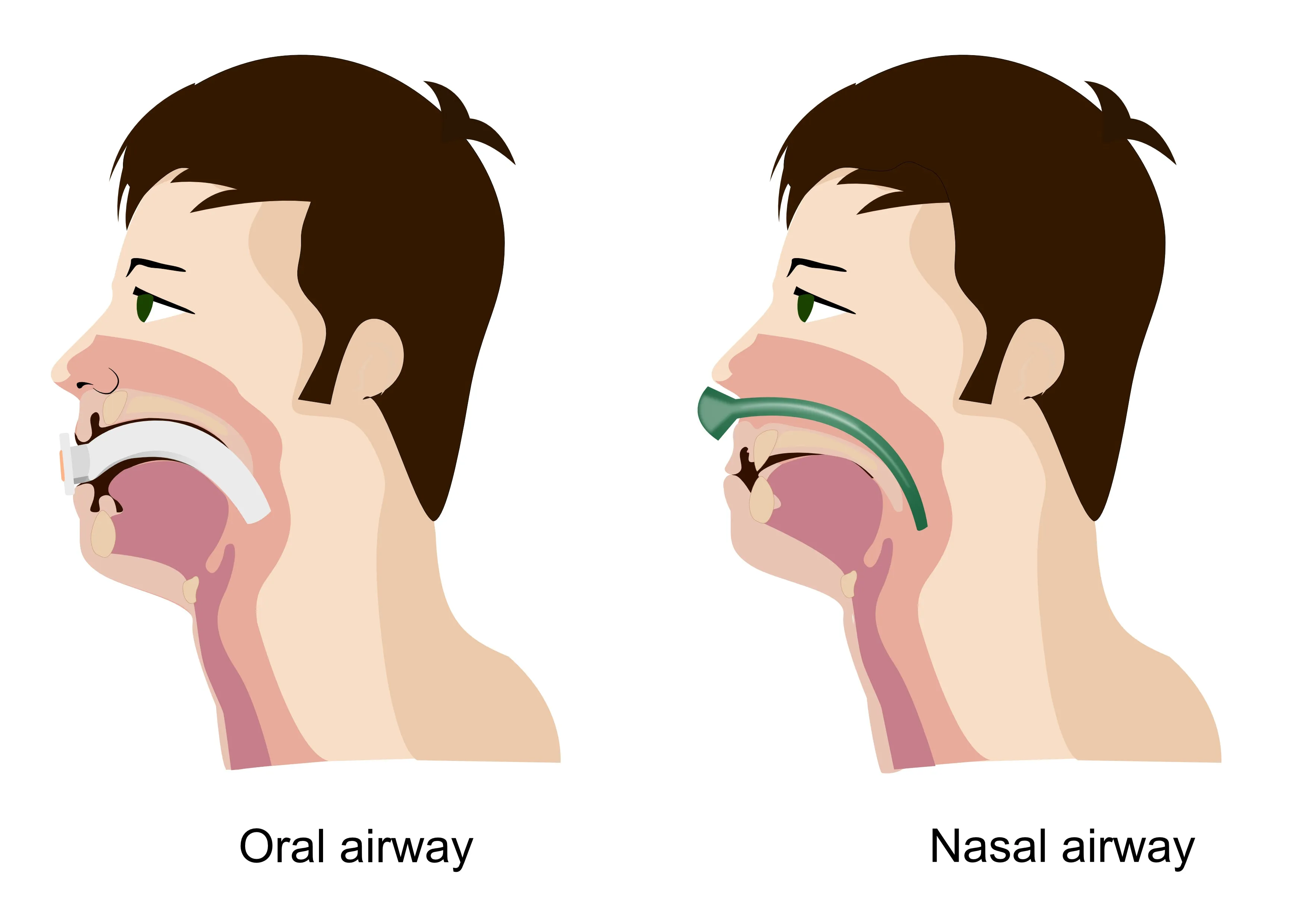 Complete Airway Emergency KIT 4